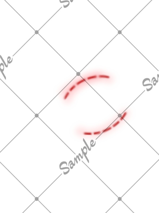 【無料だよ】シンプルな傷跡テクスチャ