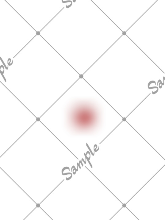 【無料だよ】シンプルな傷跡テクスチャ