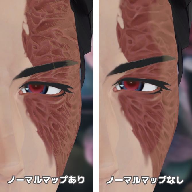 【ヴラウ専用】やばめの火傷+ノーマルマップ