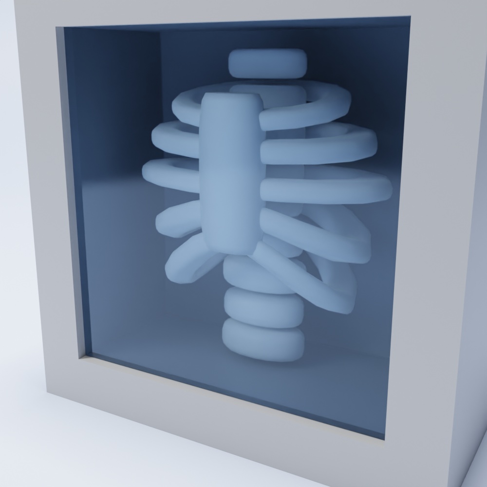 【無料配布】レントゲン