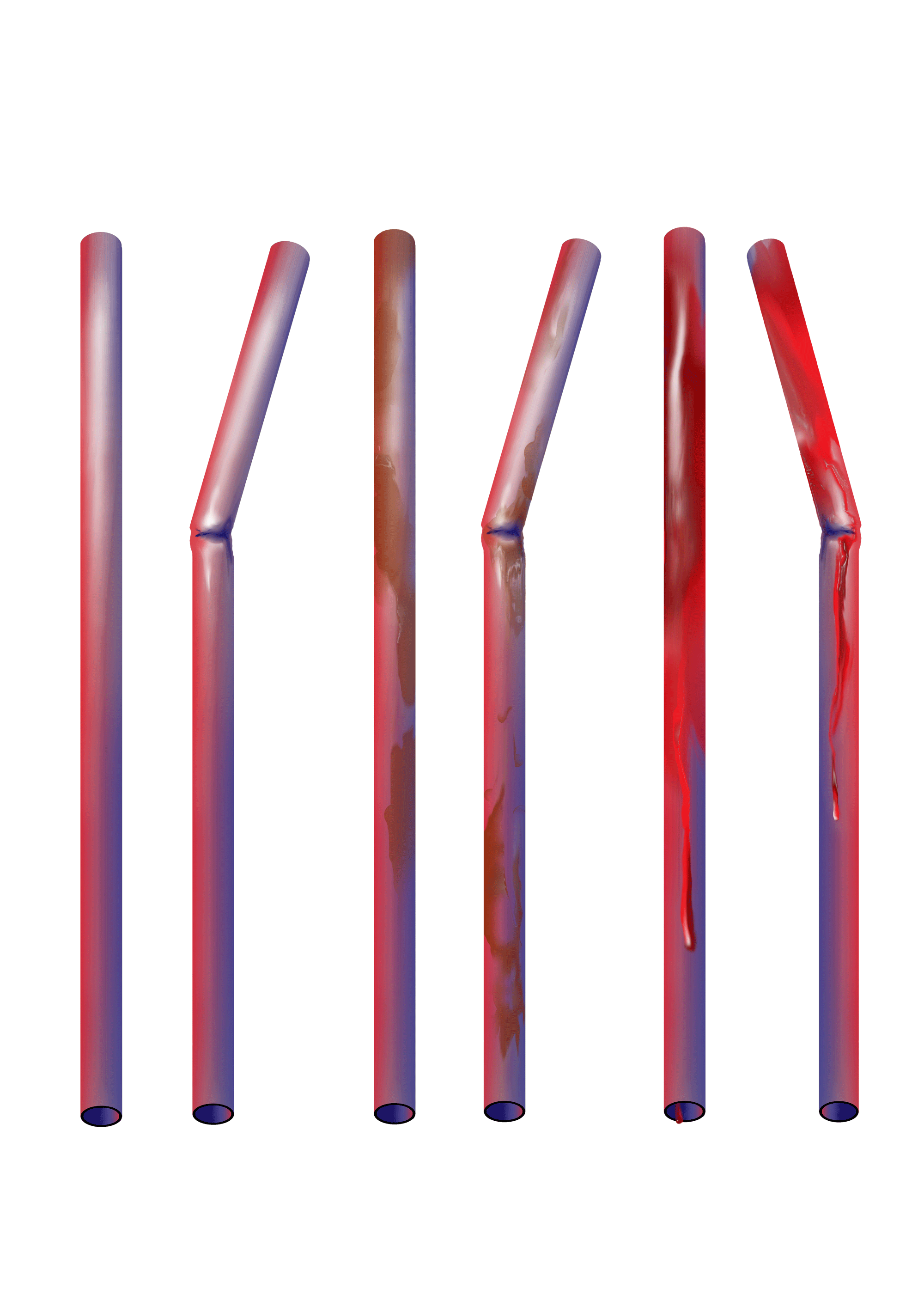 パイプセット(配管)  Pipe Set