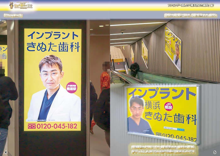 「インプラントは!きぬた歯科の世界」・ #横浜きぬた歯科 編