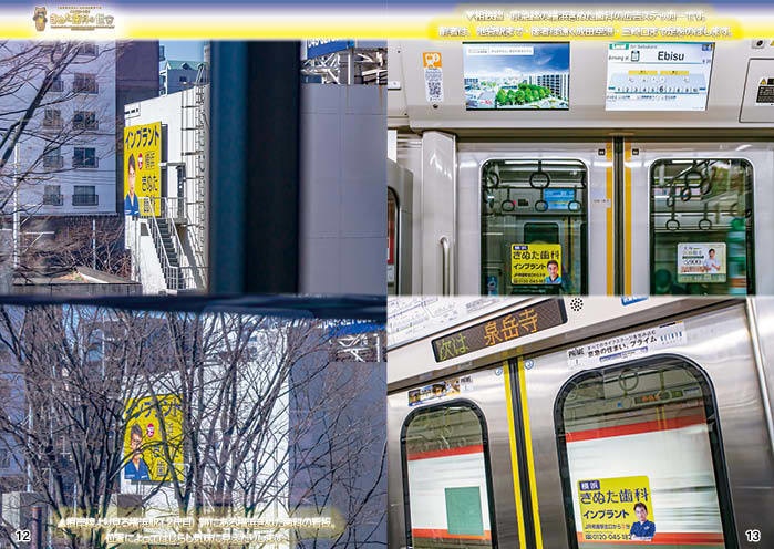 「インプラントは!きぬた歯科の世界」・ #横浜きぬた歯科 編