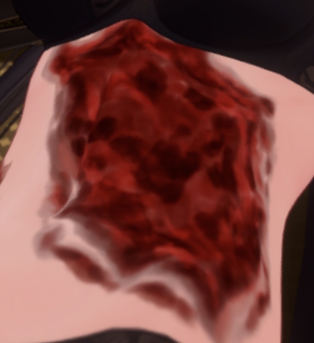 【無料配布】火傷テクスチャー灼痕の痕跡