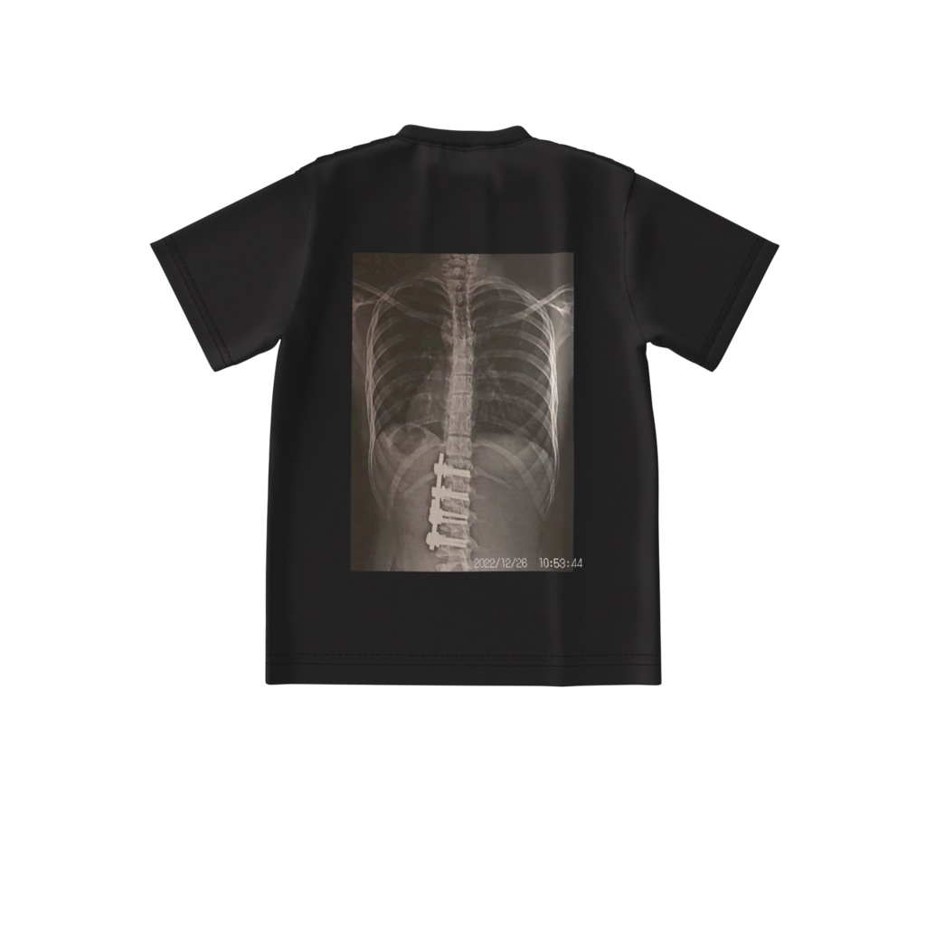 リアルレントゲンTシャツ　2022年版