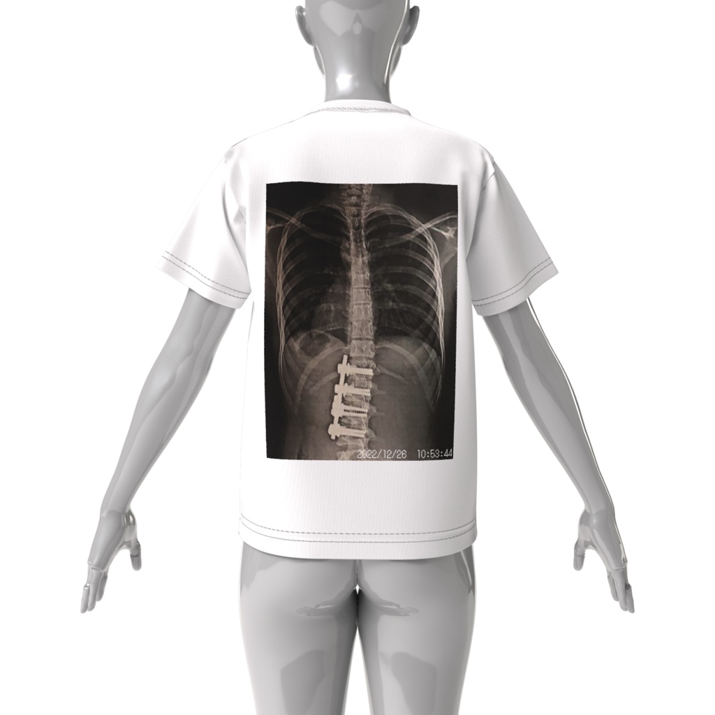 リアルレントゲンTシャツ 2022年版