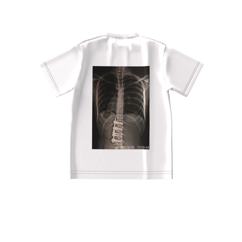 リアルレントゲンTシャツ　2022年版