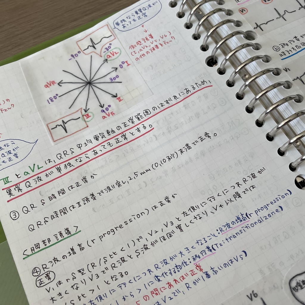 3秒で心電図を読む本 - 健康