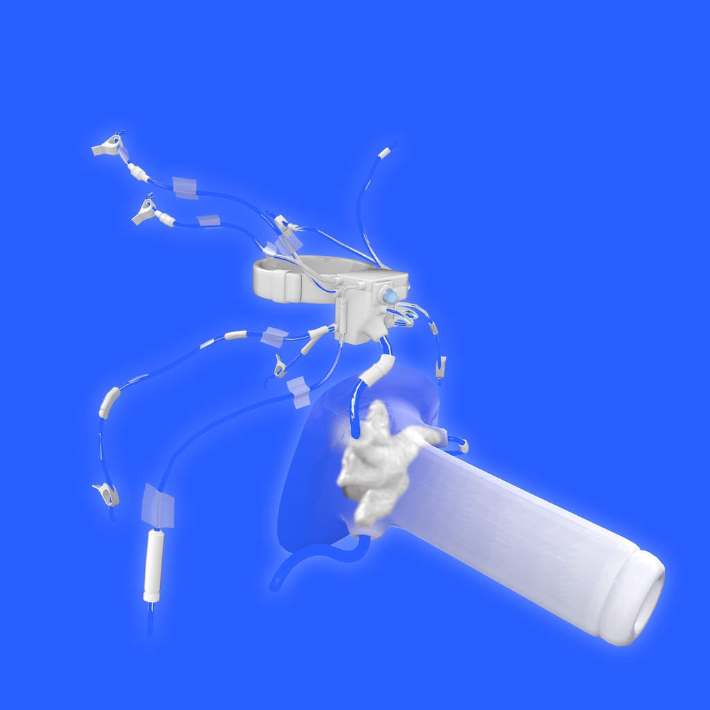 【サナティア専用】Graft Preservation Shell 移植片保護