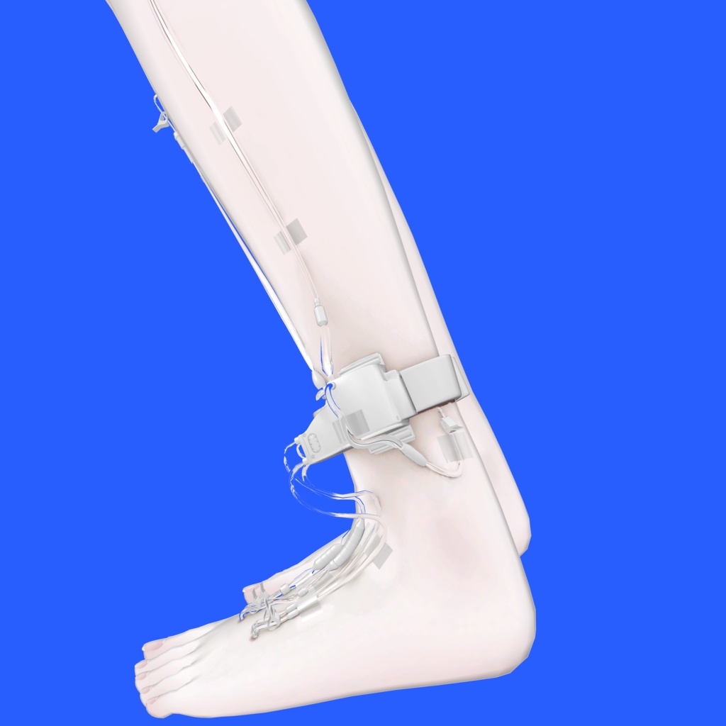 【サナティア専用】Graft Preservation Shell 移植片保護