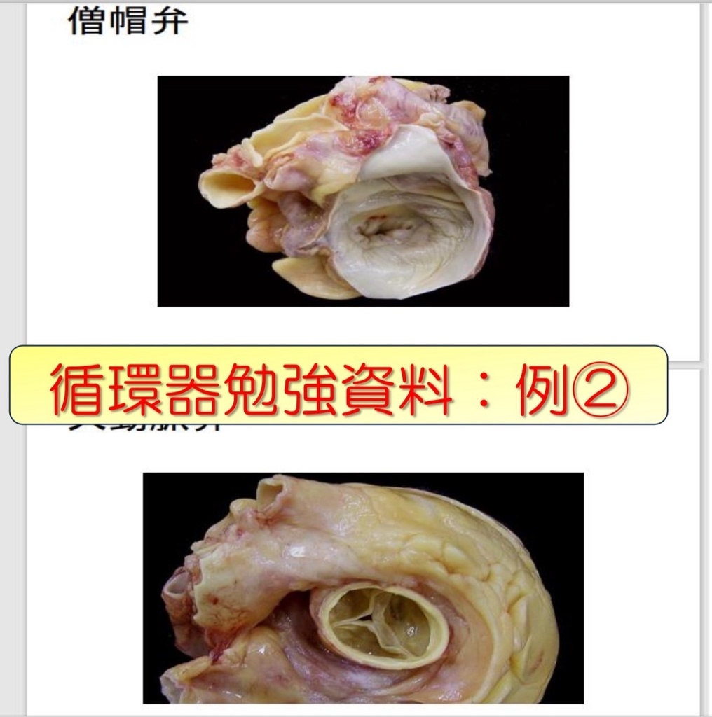 心電図試験対策3~4級 みっちりセット
