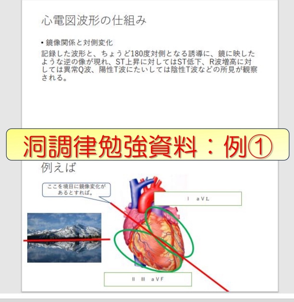 心電図試験対策3~4級 みっちりセット