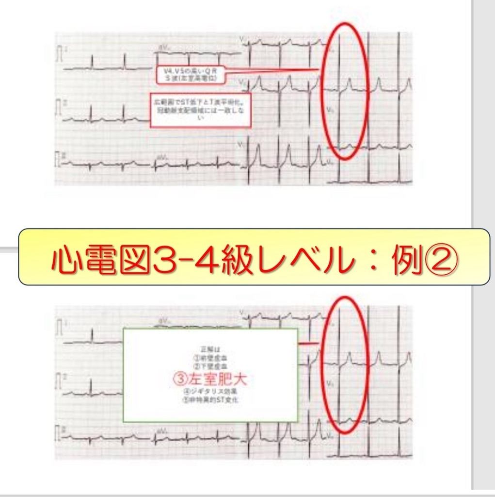 心電図試験対策3~4級 みっちりセット
