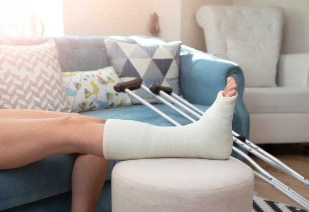 足関節踵骨骨折・果部骨折への介入　初学者向け