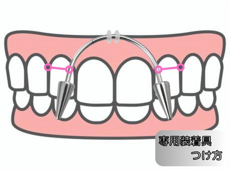 スクランパーフェイクピアス　変えゴムのみ