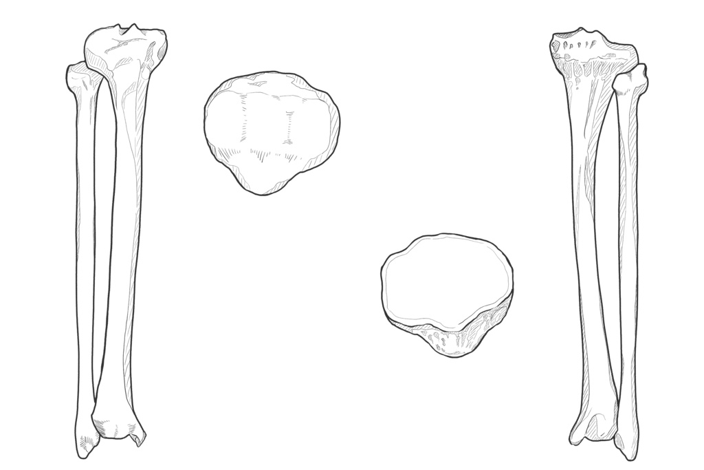 脛骨・腓骨・膝蓋骨