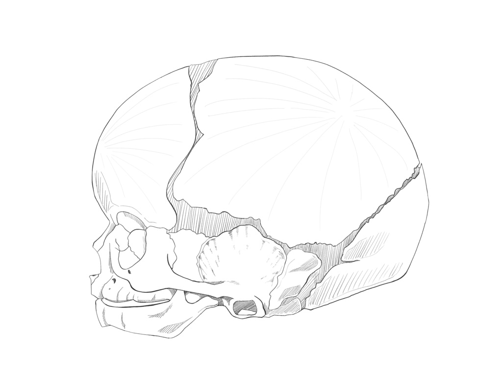 縫合　新生児の頭蓋　透過なし