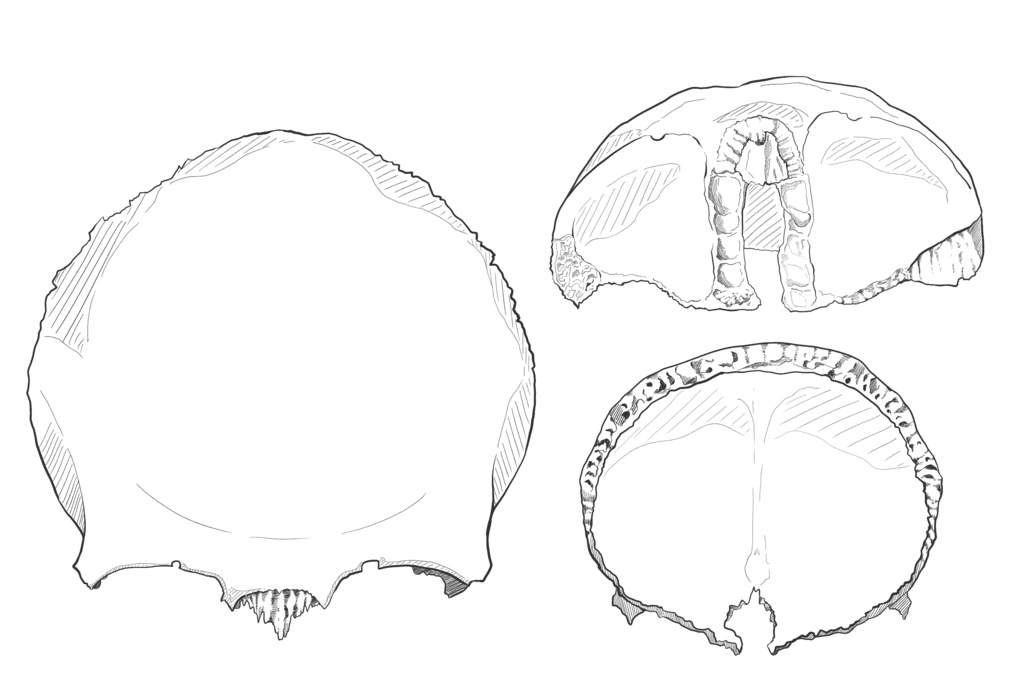 前頭骨　透過なし