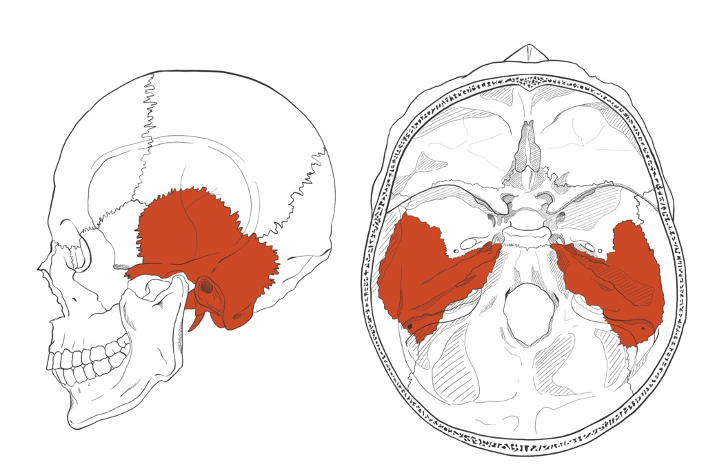 側頭骨 透過なし