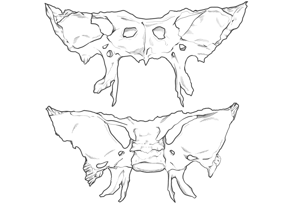 蝶形骨 透過なし