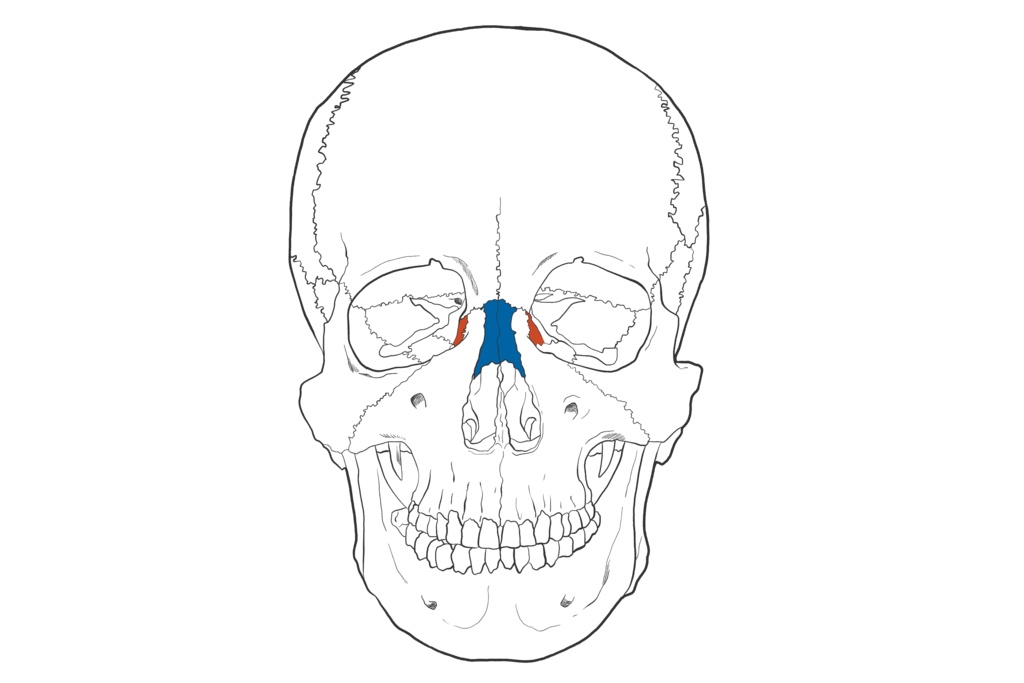涙骨 鼻骨 透過なし