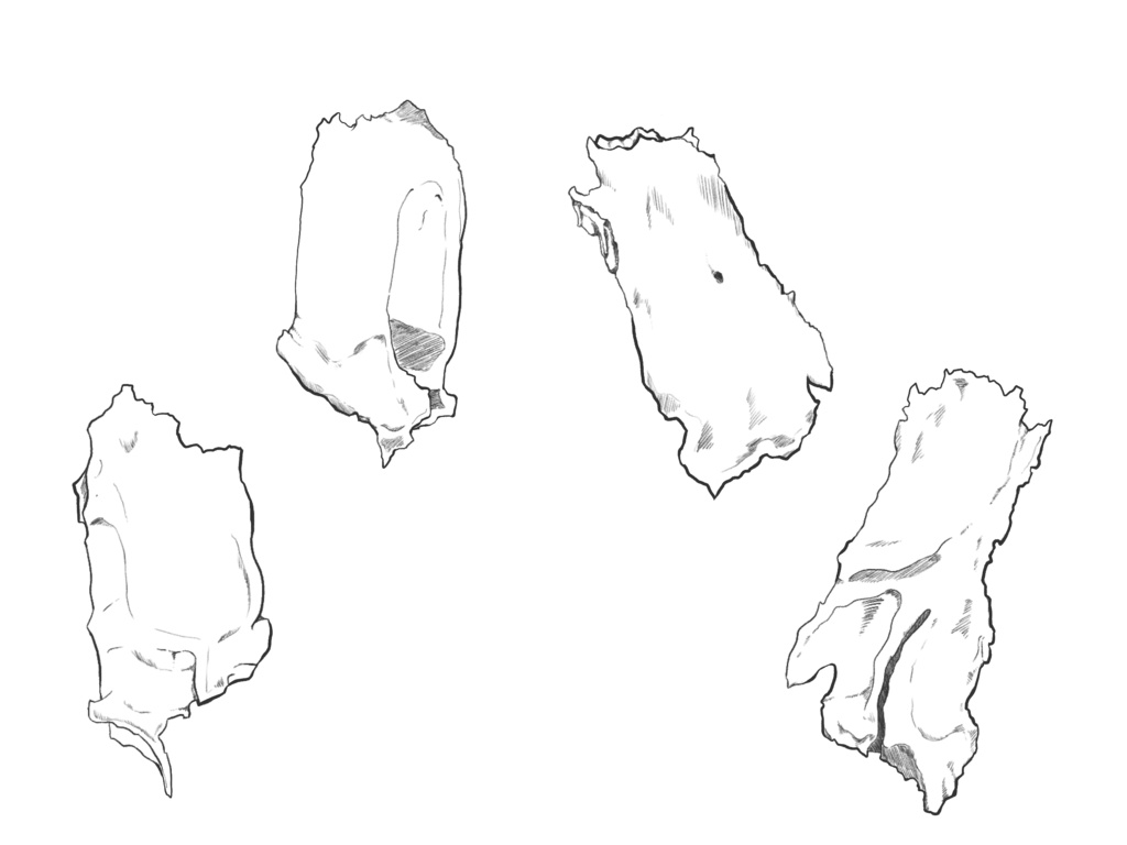 涙骨 鼻骨 透過なし