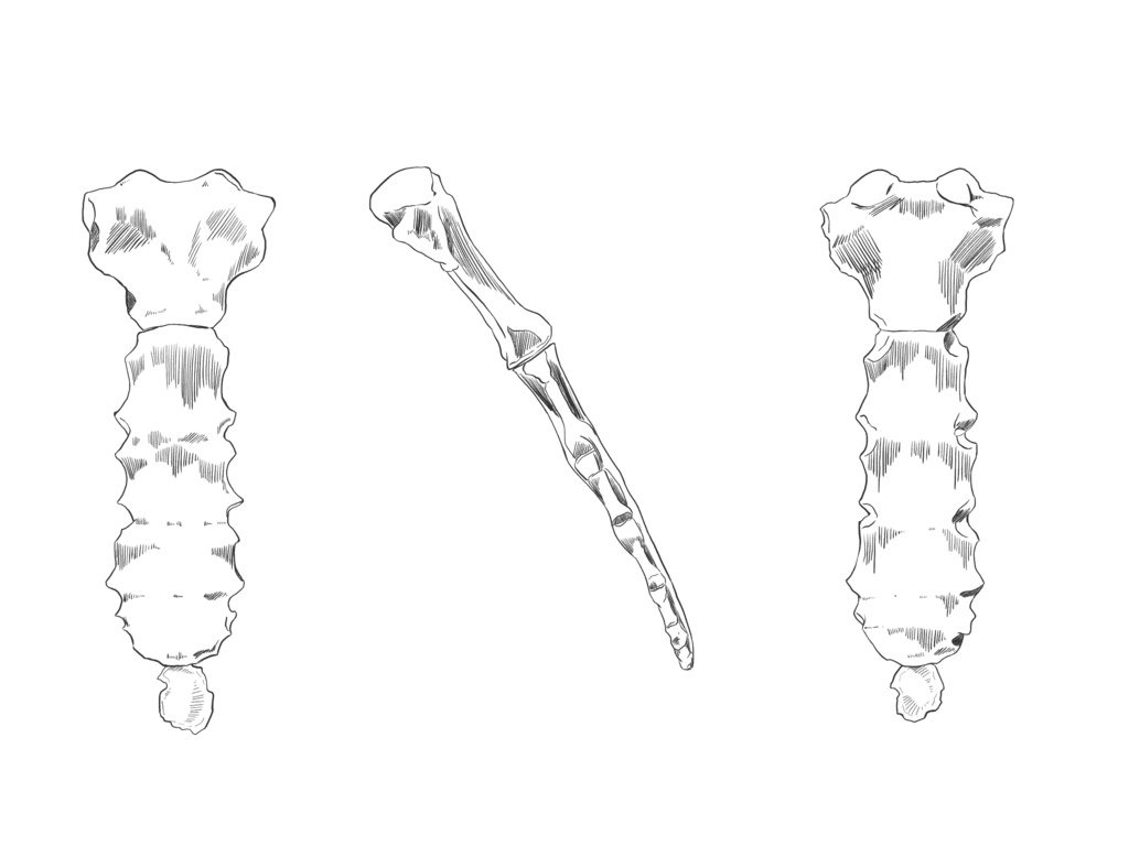 胸骨　透過なし