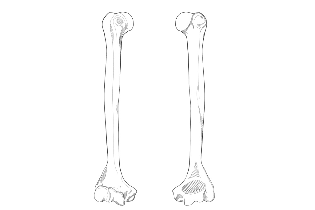 上腕骨 透過なし