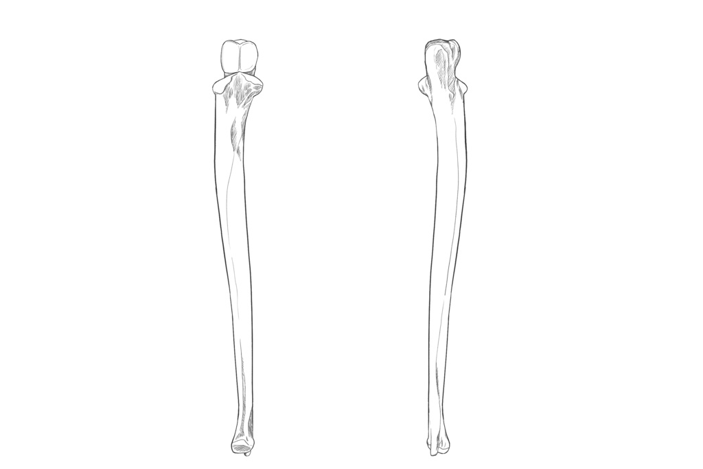 尺骨　透過なし