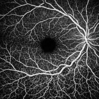 眼科画像オーバーレイ比較ツール|眼底・OCT画像を直感的に重ねて保存(ローカルHTML)