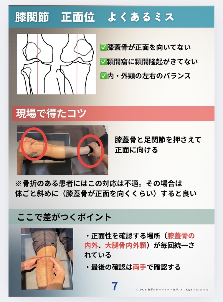 整形外科領域のXP撮影を月平均600件以上行う診療放射線技師が現場で得たコツをまとめた業務ノート 膝編「改訂版(2025年10月更新)」