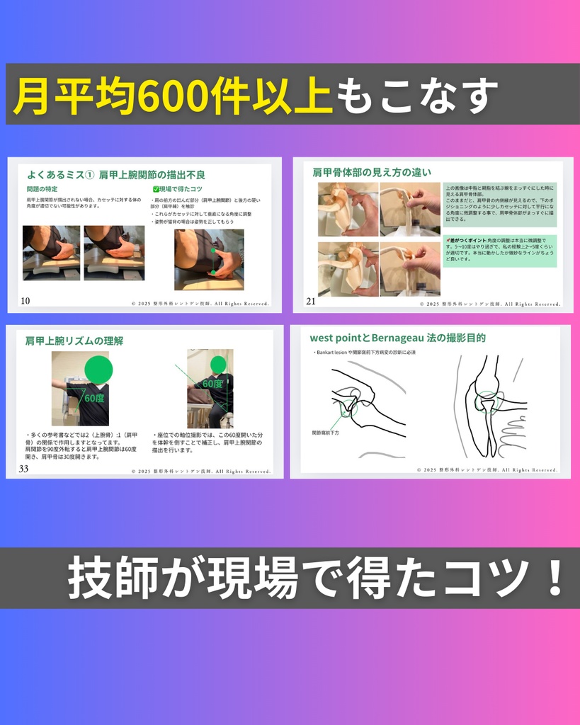 肩関節 レントゲン撮影の現場で得たコツをまとめた業務ノート