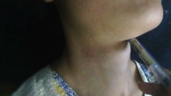 adams apple play with finger and pen