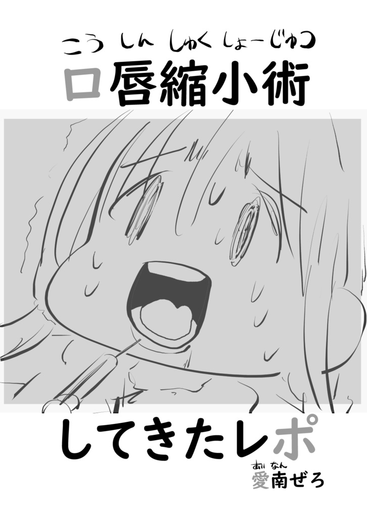 口唇縮小術してきたレポ