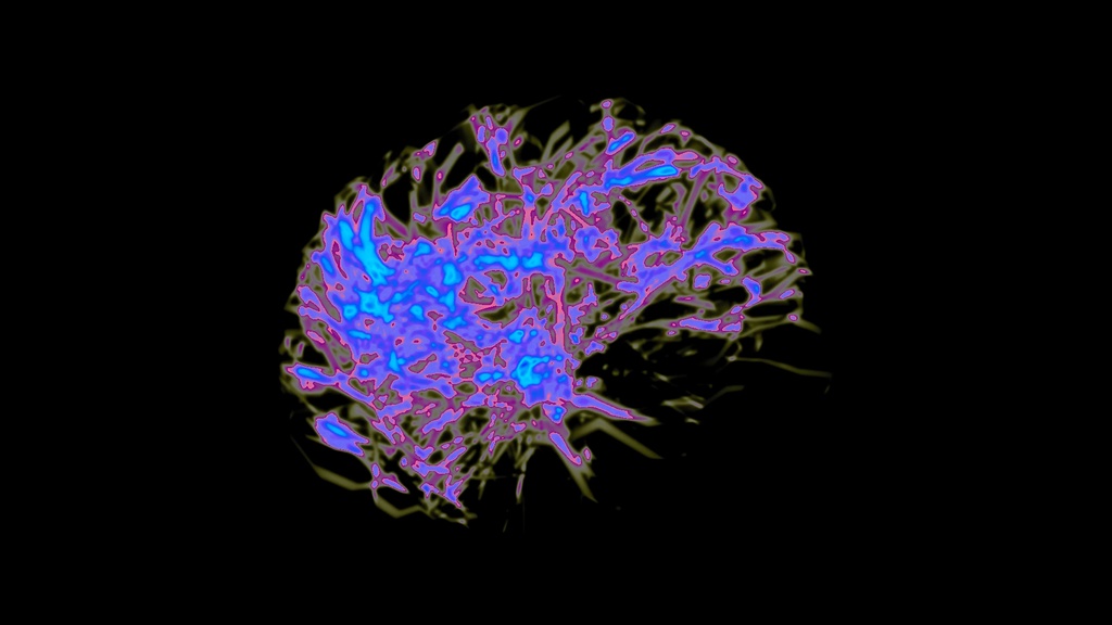 【APNG+動画】脳神経・臓器活動【ループ+透過有】