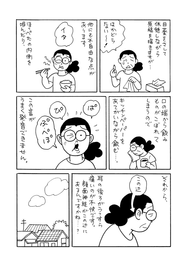 顔面マヒになりました!