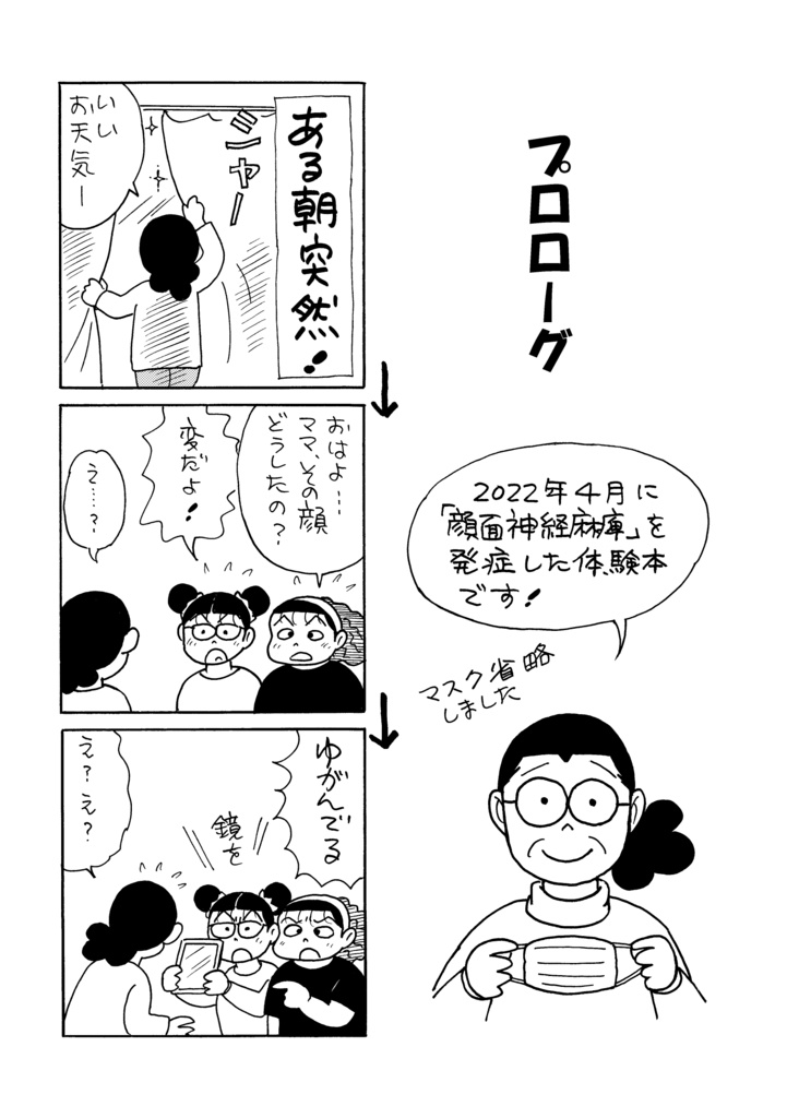 顔面マヒになりました!