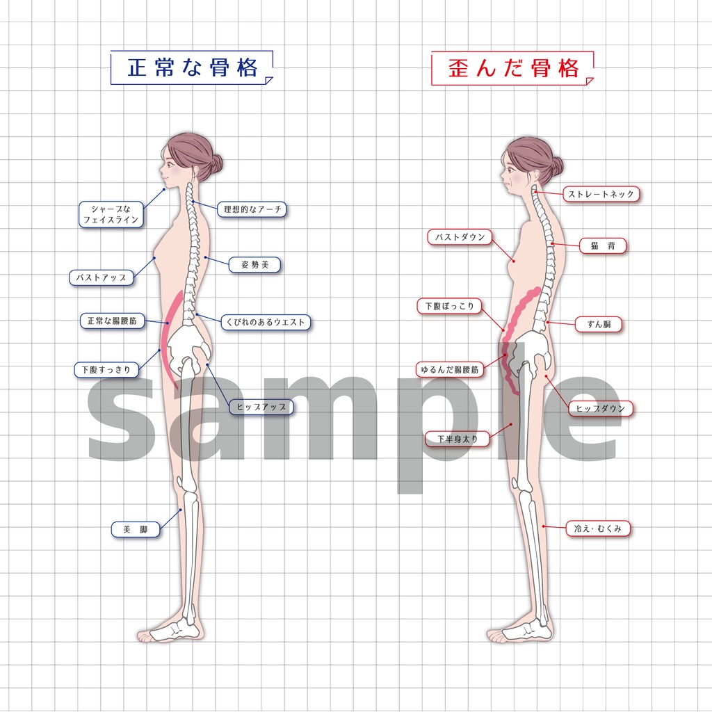 正常な骨格 歪んだ骨格イラスト 印刷用 5863 Booth