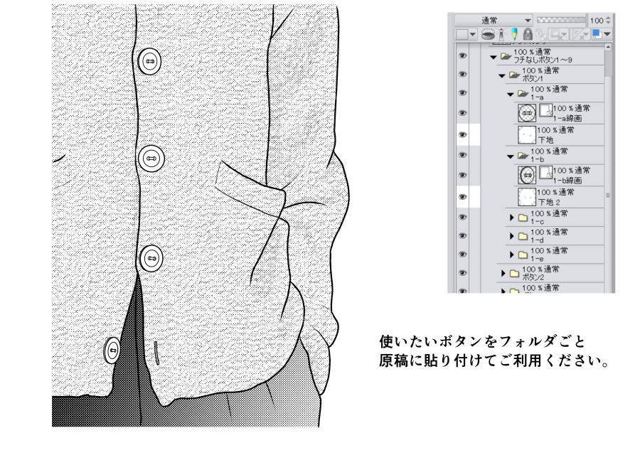 山吹ボタンセット