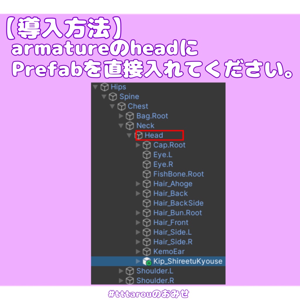 【無料/Free】キプフェル専用 歯列矯正器具
