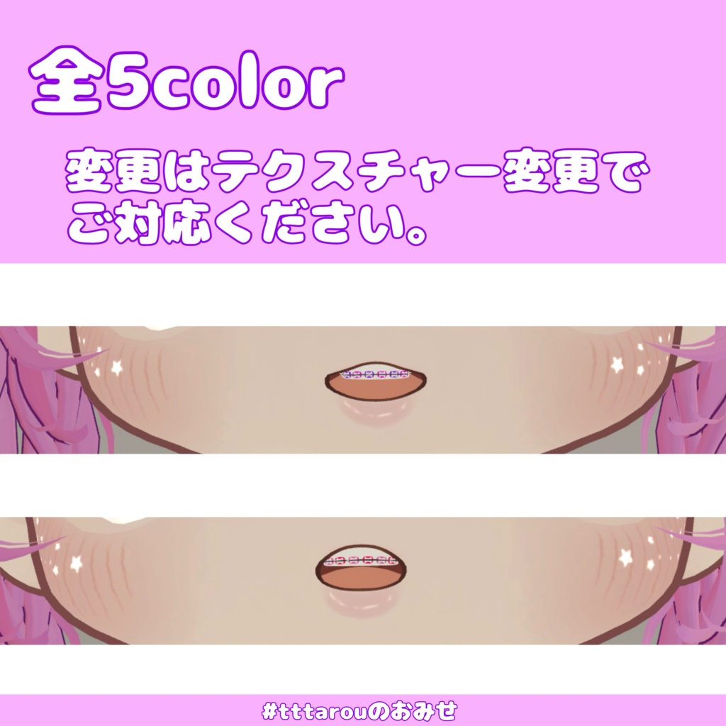 【無料/Free】キプフェル専用 歯列矯正器具