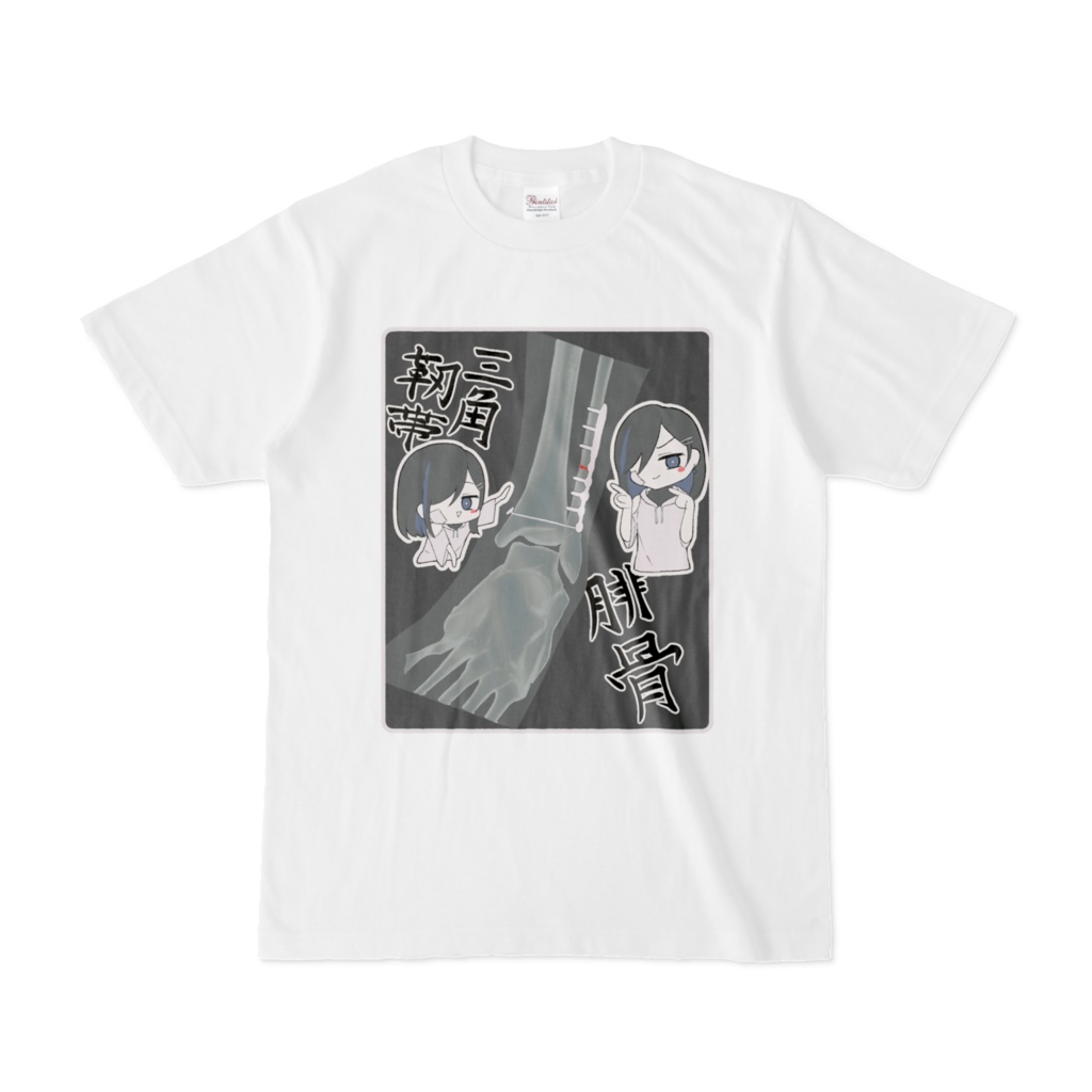 左腓骨三角靭帯損傷Tシャツ白(安いね!)