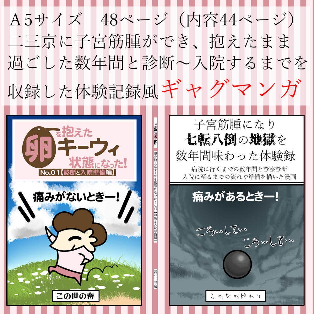 【子宮筋腫体験記】 卵を抱えたキーウイ状態になった！