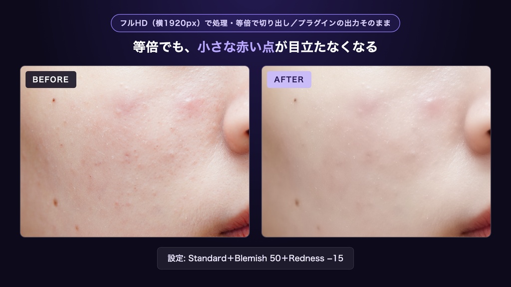 美肌・肌補正プラグイン|Premiere Pro/After Effects用 Totonoe Skin Retouch(買い切り)