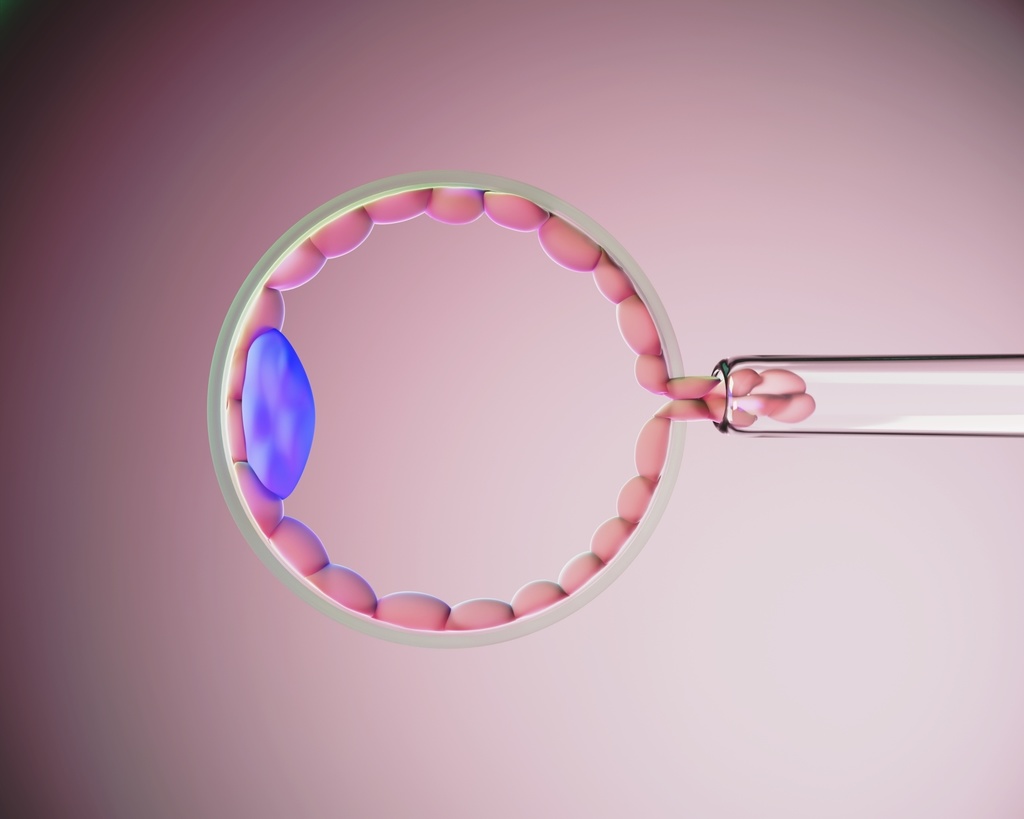 ヒト胚盤胞のバイオプシーを描いた3DCGイラスト画像