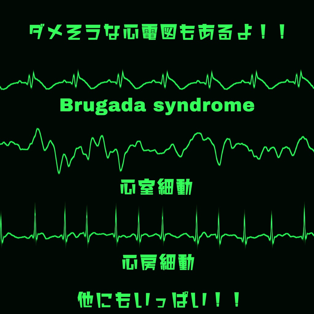 【無料】細かすぎて伝わらない心電図シェーダー【VRChat想定】
