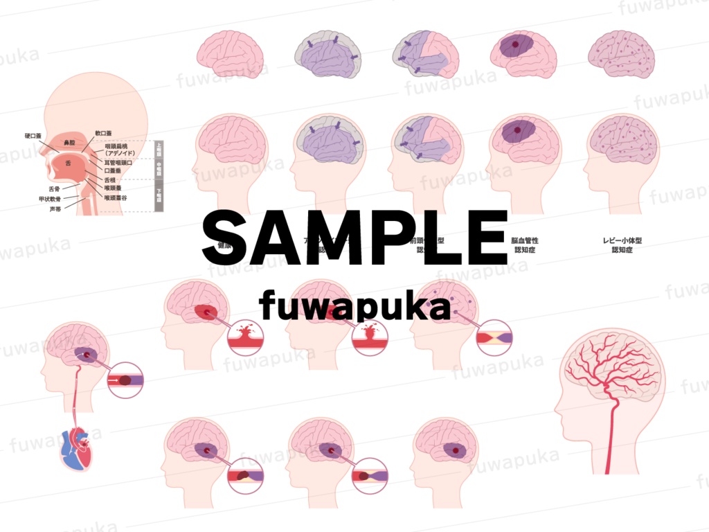 脳・口腔の矢状断_脳血管障害_嚥下のイラスト素材_ベクター