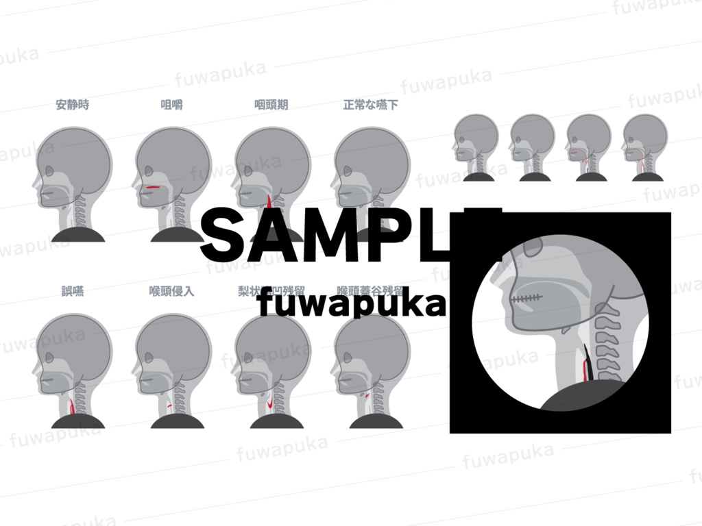 脳・口腔の矢状断_脳血管障害_嚥下のイラスト素材_ベクター