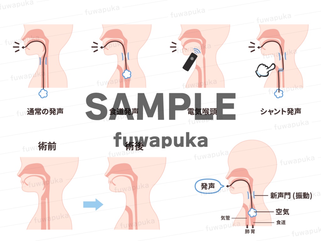 食道発声のイラスト素材_ベクター