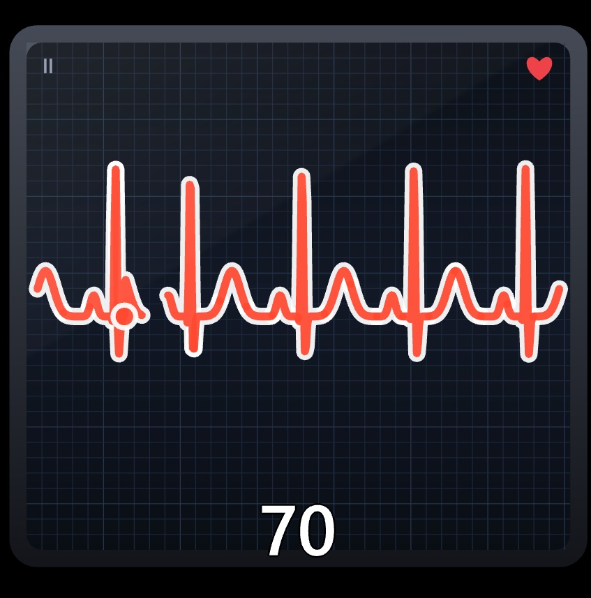 【ASMR配信向け】心音に連動して鼓動する心臓ソフトウェア:StreamHeartbeat(ぬ)